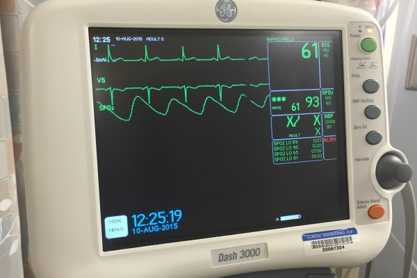 EKG tracing of heart activity on a cardiac monitor. 