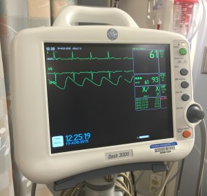 a heart monitor showing a heart tracing EKG