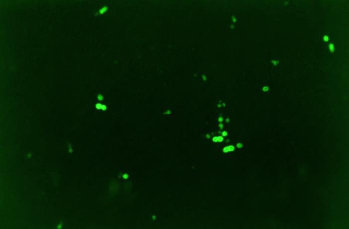 digitally colorized photomicrograph, of a number of Streptococcus pneumoniae bacteria