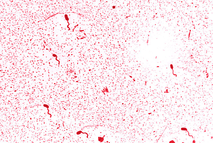 bacteria under the microscope