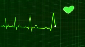 EKG tracing