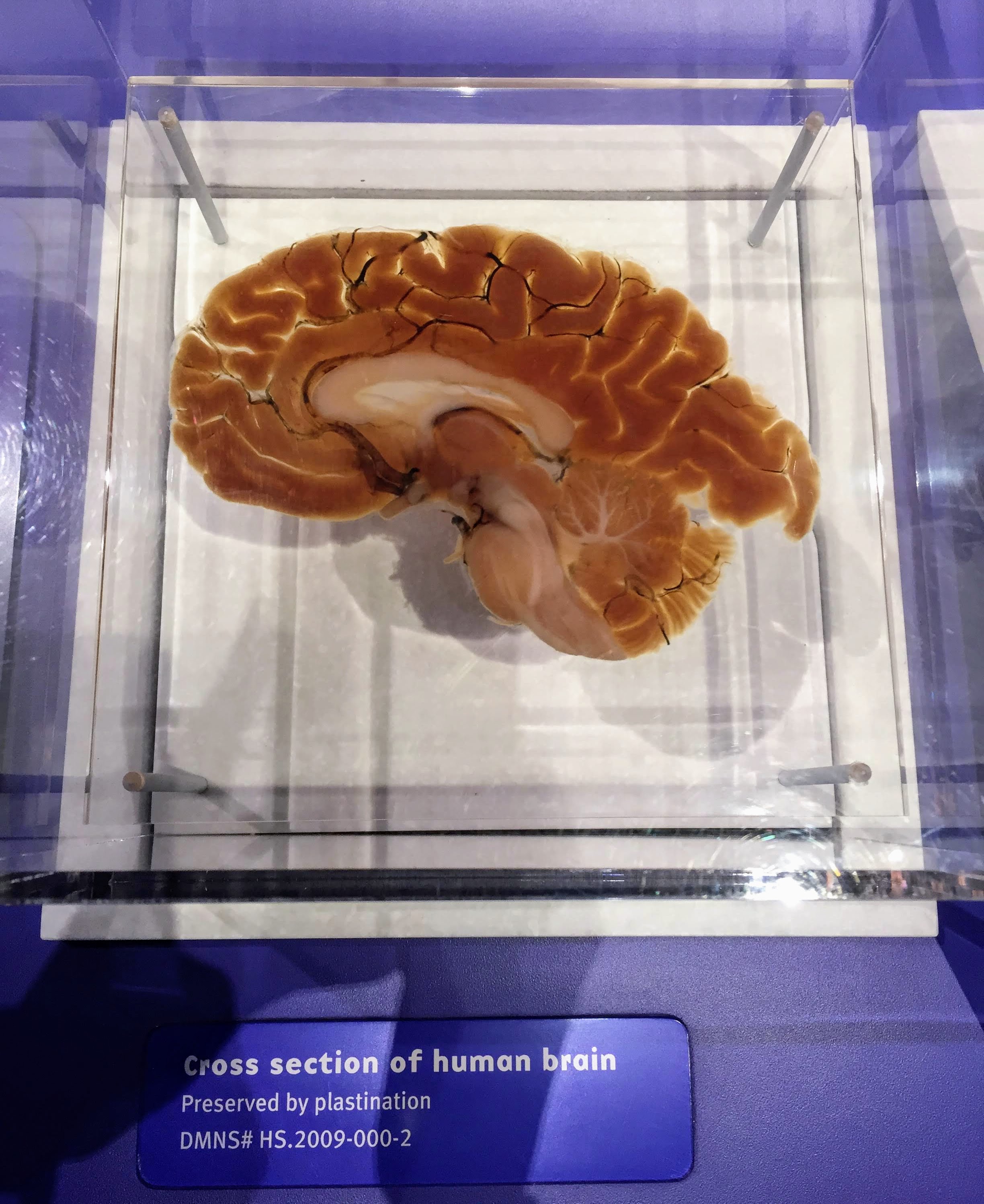 cross section of the human brain