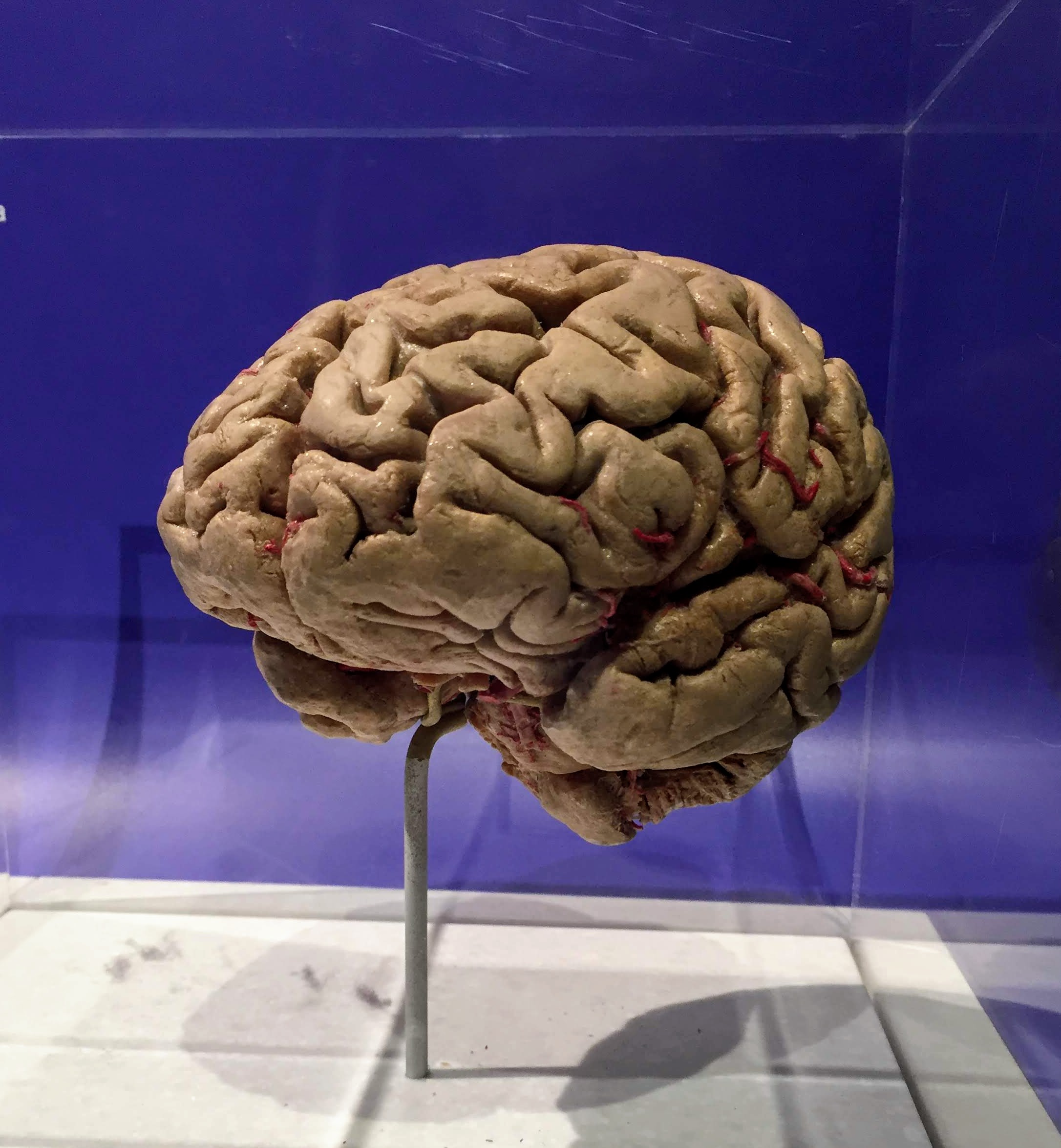 a preserved human brain