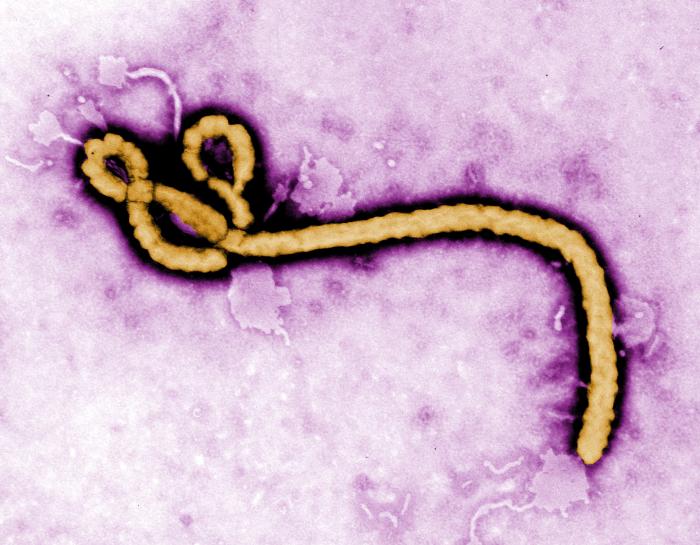 an electron image of the Ebola virus