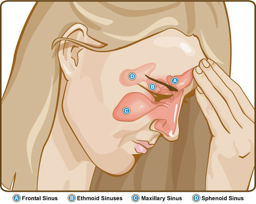 a diagram of the sinuses
