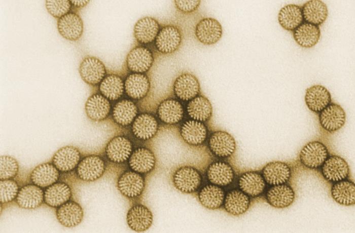 electron microscopic (TEM) image of rotavirus
