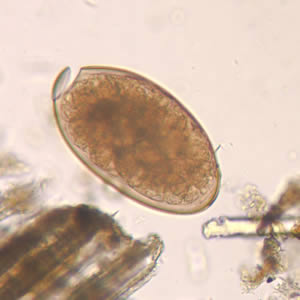 Fasciola hepatica egg in an unstained wet mount (400x magnification): F. hepatica eggs are broadly ellipsoidal, operculated, and measure 130–150 μm by 60–90 μm. (CDC Photo: DPDx)