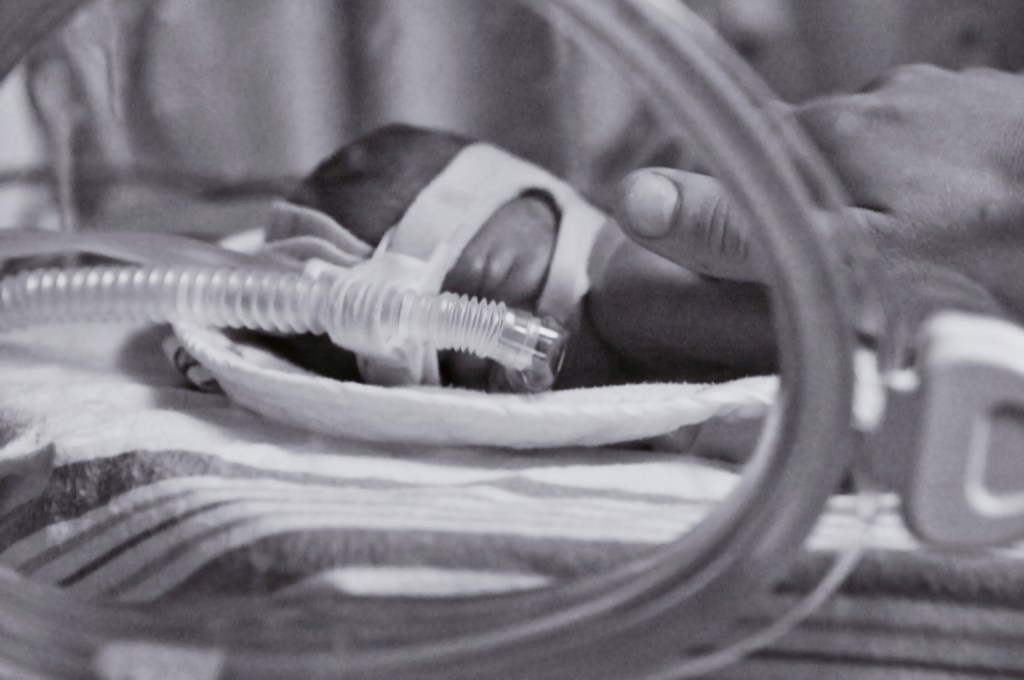 a tiny baby lying in a bed with a breathing tube