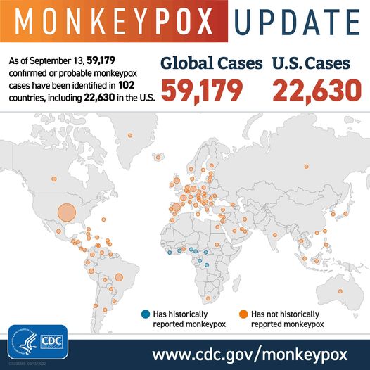 As of September 13, 2022 there are 59,000 global cases and 22,000 United States cases of monkeypox.